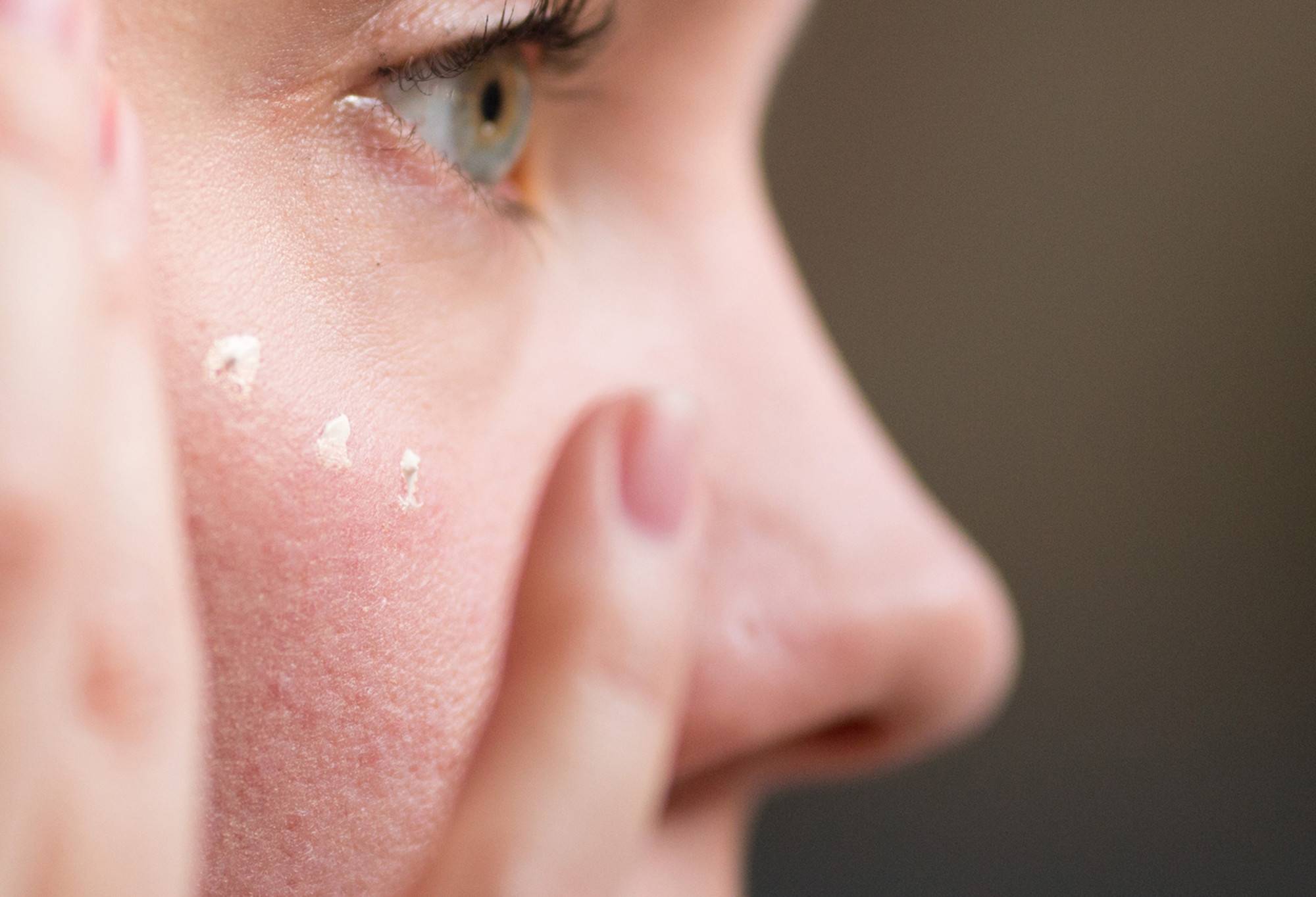 Alternative view of Feeling Younger